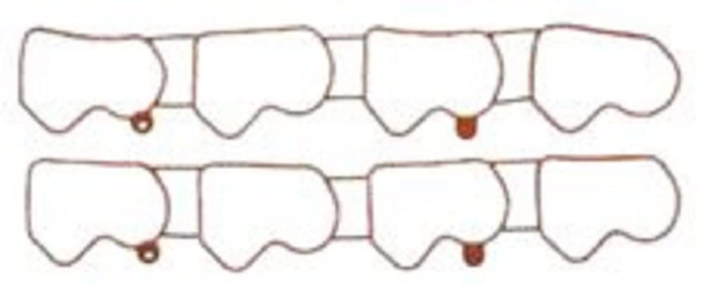 Engine Intake Manifold Gasket Set MAHLE MS16287